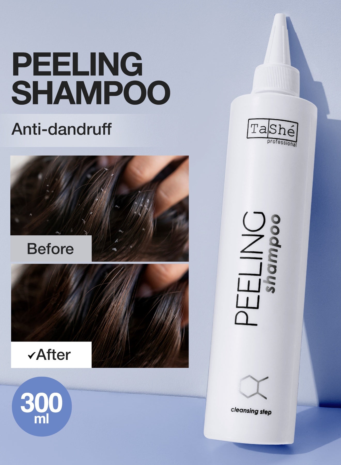 Exfoliating Shampoo. Cleanses The Scalp, Eliminates Dandruff and Greasy Hair, Adds Volume, Has A Tonic And Cleansing Effect. Get Back To Healthy and Clean Hair (300 ml)