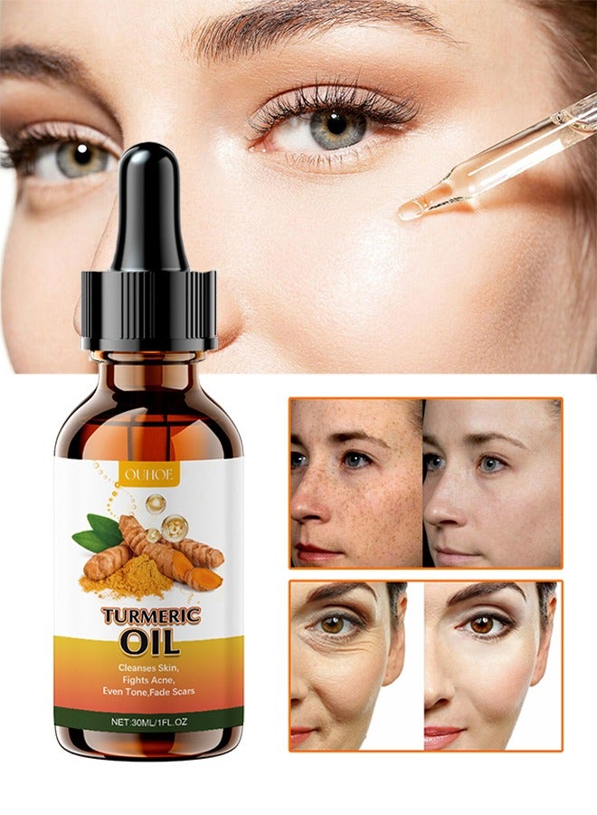 Turmeric Oil, Turmeric Dark Spot Correcting Serum Oil, Turmeric Repair Face Serum, Natural Turmeric Bright Skin Dark Spot Skin Care Moisturizing Repair Serum, Turmeric Oil for Face Dark Spots 30ml