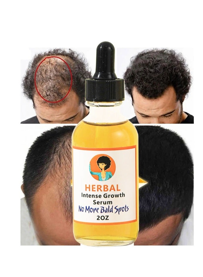 Herbal Hair Growth Oil And Serum  Dry Scalp Treatment, Hair Thickening Products for Women, Hair Loss Essential Oils For Diffuser 2OZ
