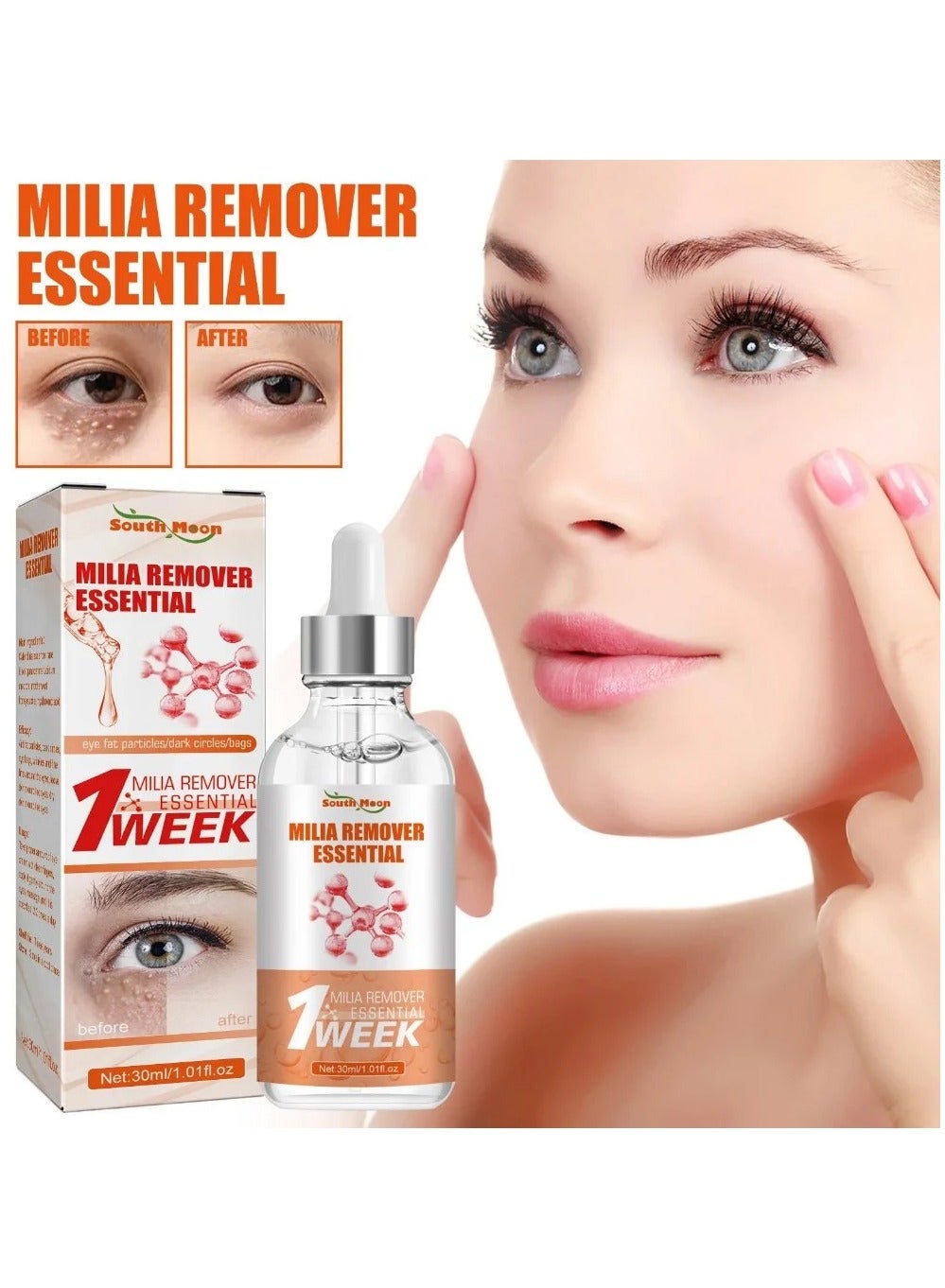 South Moon 30ML Milia Remover Essential Eye Serum Effective Removes Fat Granules Eye Bags Anti-Particles Puffiness Improve Dark Cicle
