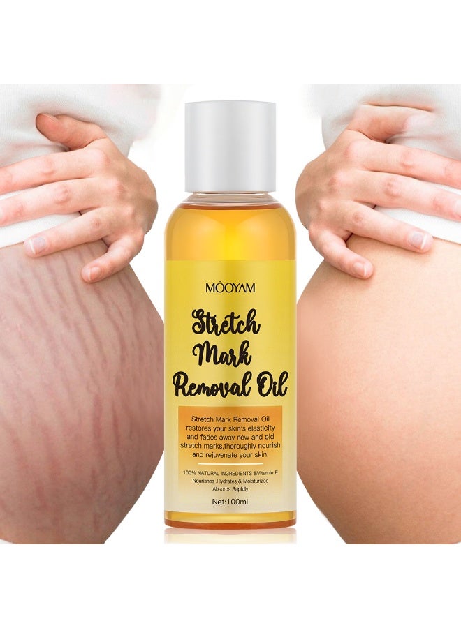 Stretch Mark Removal Oil with Vitamin E for Fading New Old Marks Improves Skin Elasticity Fast Absorbing Hydrating Body Treatment for Pregnancy and Weight Loss 100ml