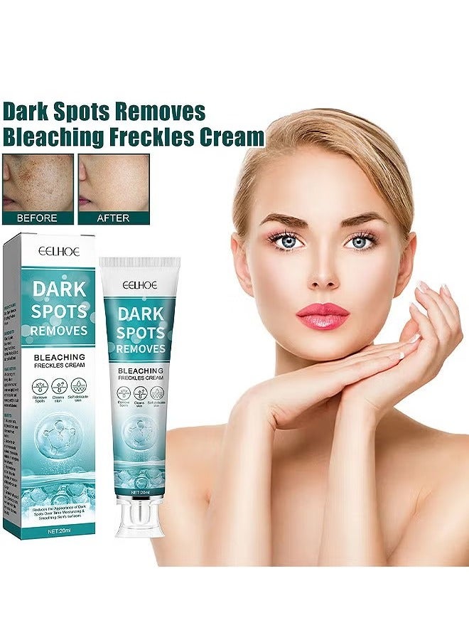 Dark Spot Removes Bleaching Freckles Cream For Face, Fast-Acting Dark Spot Corrector Remover For Face And Body Hyperpigmentation, Fades Melasma, Freckle, Sun Spots, Evens Skin Tone, Age Spot Remover