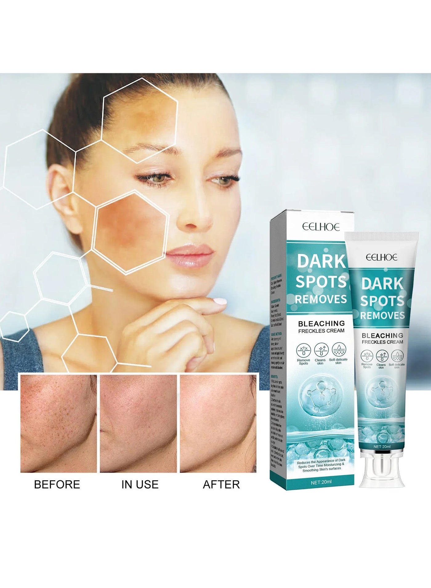 Dark Spot Remover for Face Hyperpigmentation Treatment Dark Spots, Melasma, Freckle, Sun Spots Removal Dark Spot Corrector Cream for Women and Men 20g