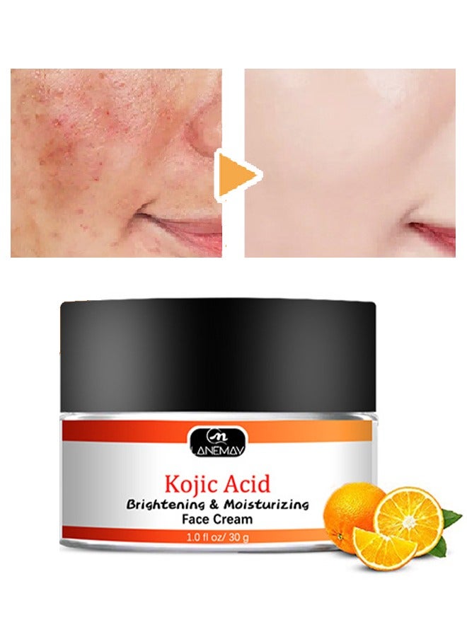 Kojic Acid Face Cream 30g, Moisturizing Brightening the Skin, Lightweight Non-Greasy Deep Penetration Anti-Aging，Spots Or Acne Scars In A Effective Way