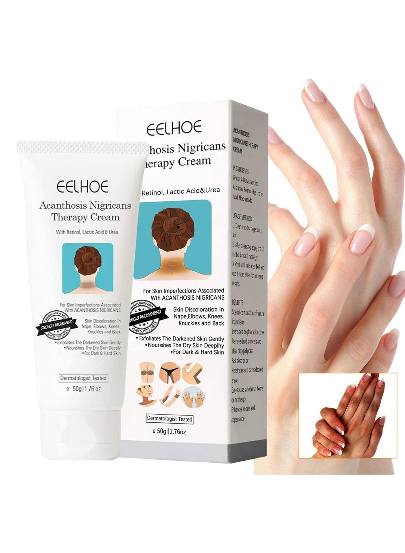 Corrector Cream for Dark Spots - Face Acanthosis Nigricans Corrector Remover - 50g Body Skin Bleach For Women Elbow Knee Ankle Neck Dark Spots Corrector Lotion