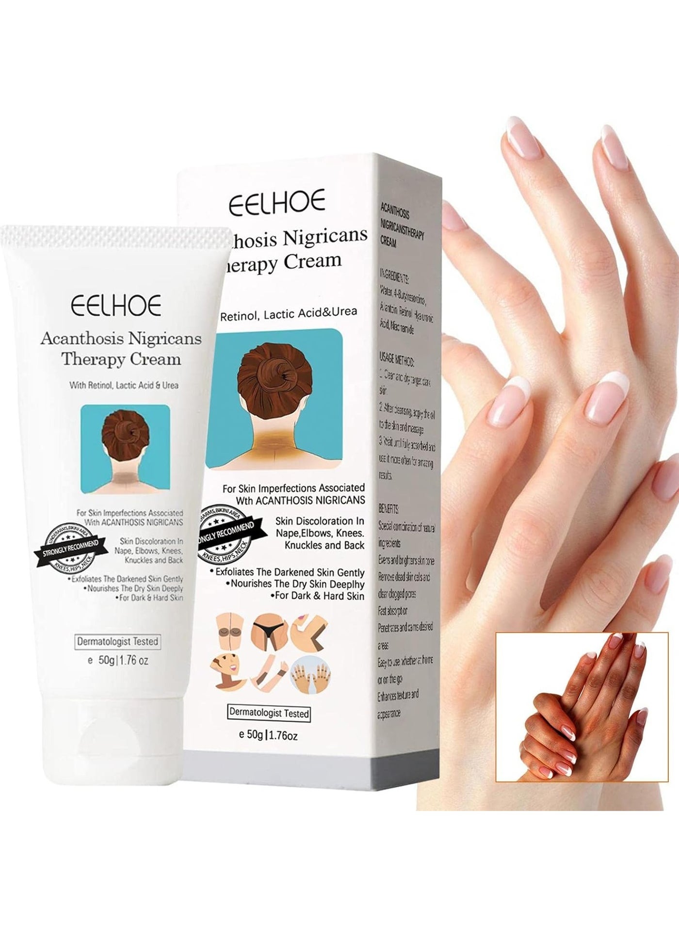 Acanthosis Nigricans Therapy Cream- with Lactic Acid ,Dermatologist Tested Retinol Cream , Hyperpigmentation Removal Cream , For Dark Body Parts like Neck Ankles Knuckles Armpits 50g