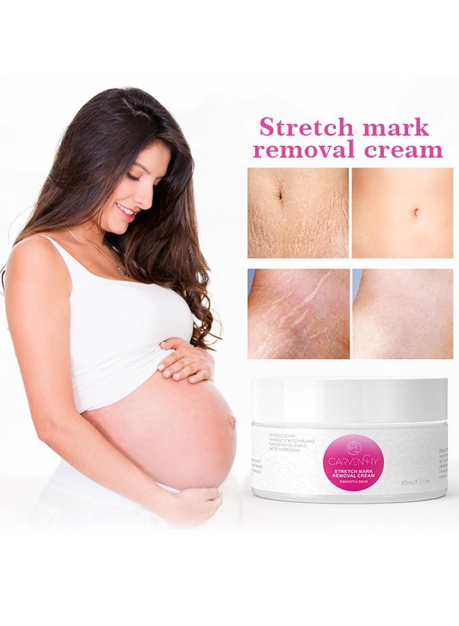Stretch Mark Removal Cream - Fat Marks,Stretch Marks Firming Repair Cream 50ML
