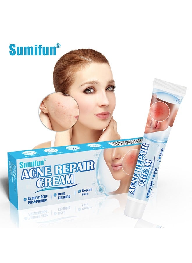 Acne Repair Cream - Acne Removing Cream Repairs Acne Pits, Lightens Acne Marks and Spot Removing Cream Moisturizes and Shrinks Pore Set,Day and Night Use 20g