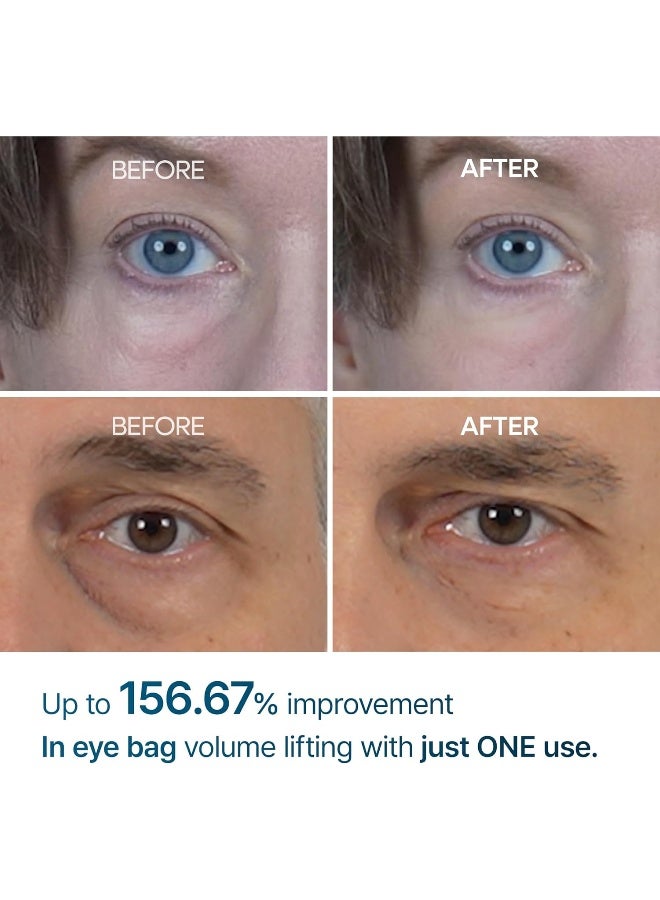 Eyephalt Eyebag Cream 10ml - image 3