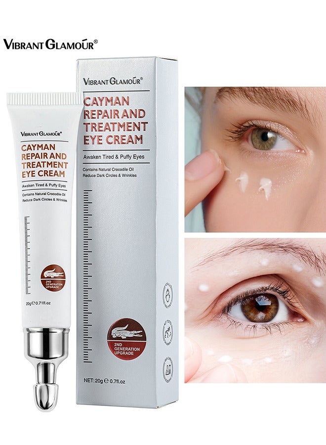 Cayman Repair And Treatment Eye Cream 20G - Magic Eye Cream - Eye Cream To Remove Eye Bags - Wrinkles - Fine Lines - Dark Circles - Anti Aging Eye Cream - Lift Lighten Eye Cream - Eye Repair And Treatment