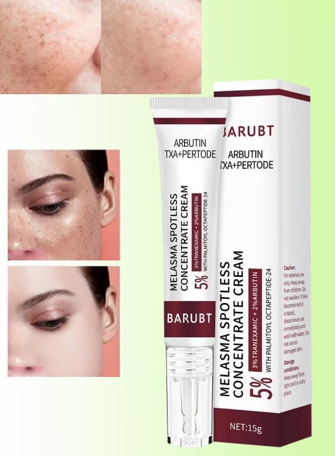 Melasma Spotless Concentrate Cream Dark Spot Cream for Face Reduce Dark Circles and Fine Lines Moisturizing Hydrating and Firming Cream Melasma Treatment Age Spots Freckle Remover Cream 15G