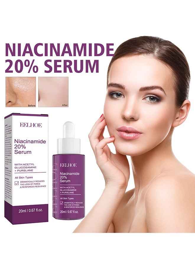 Niacinamide 20% Serum -  Face Pigment Dark Spot Remover Face Serum, Anti Aging Fragrance Free Face Essence For For Discoloration And Minimizing Large Pores 20ml