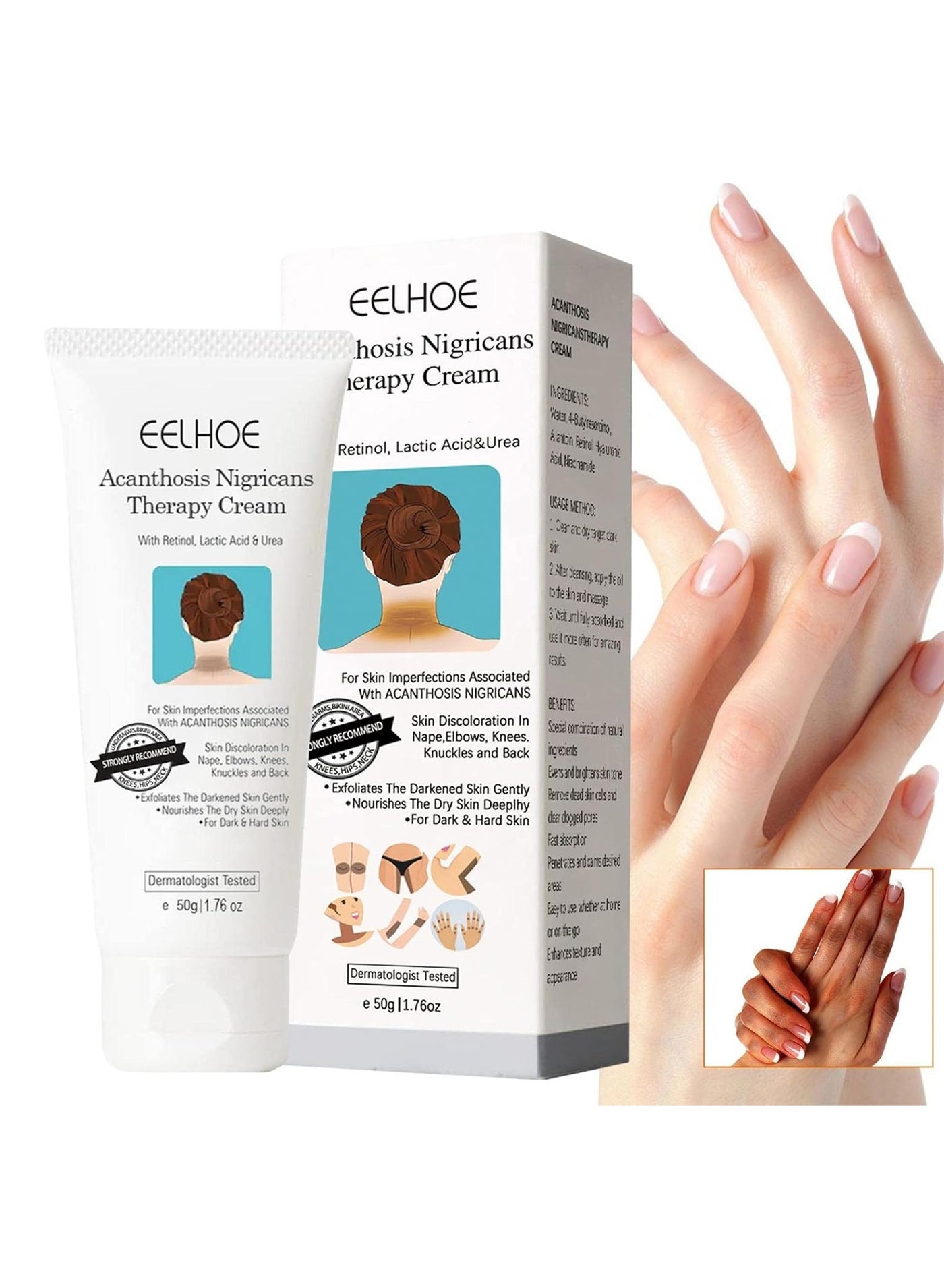 Acanthosis Nigricans Therapy Cream, Dark Spot Corrector Cream Whitening Serum, Acanthosis Nigricans Treatment, Dark Spot Removal (1PCS)