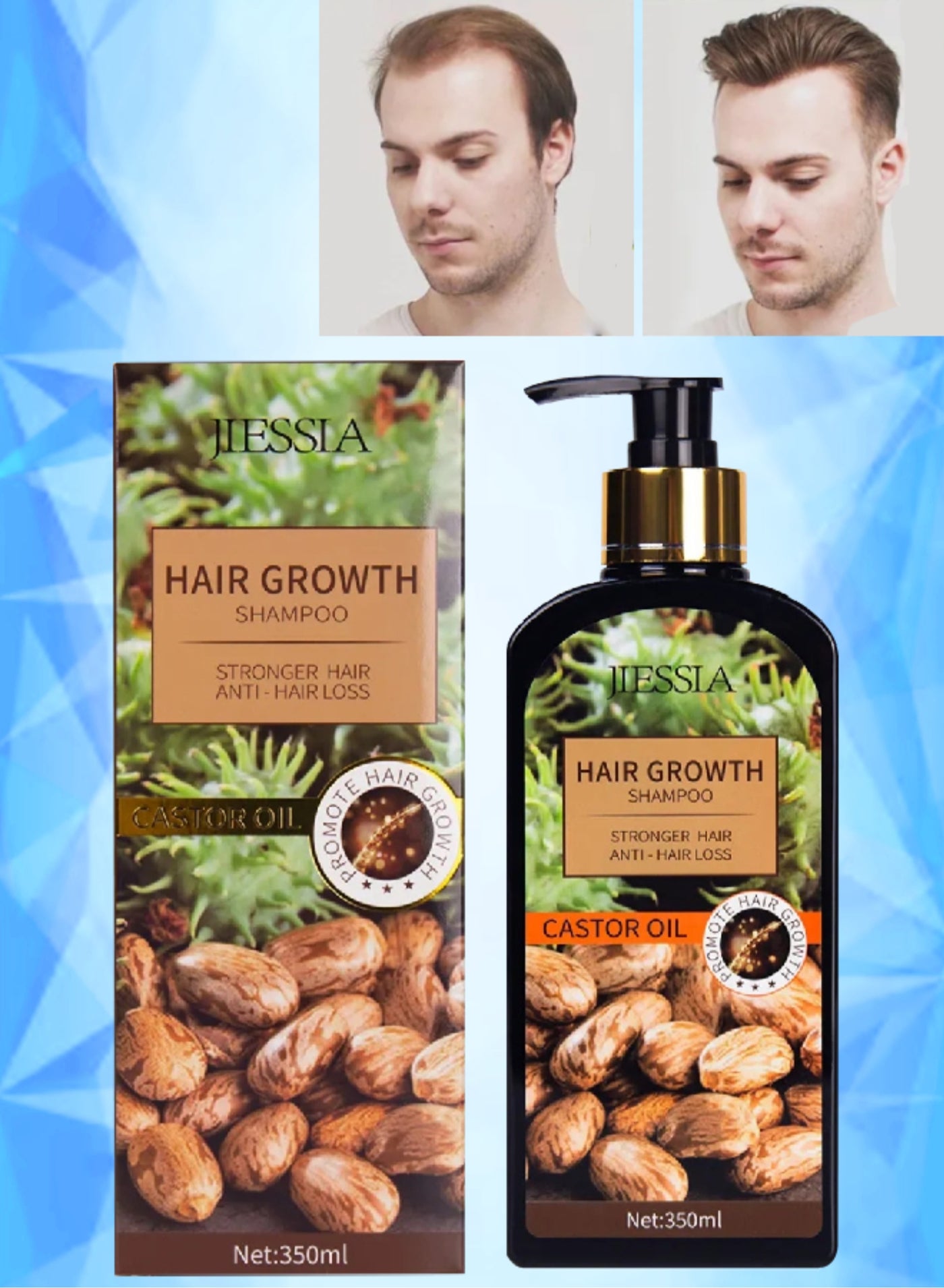 350ml Castor Oil Hair Growth Shampoo for Hair Growth and Increase Thickness Repair Dry and Damaged Hair Anti Hair Loss Shampoo Strengthens Hydrates Prevent Hair Breakage Castor Oil Shampoo