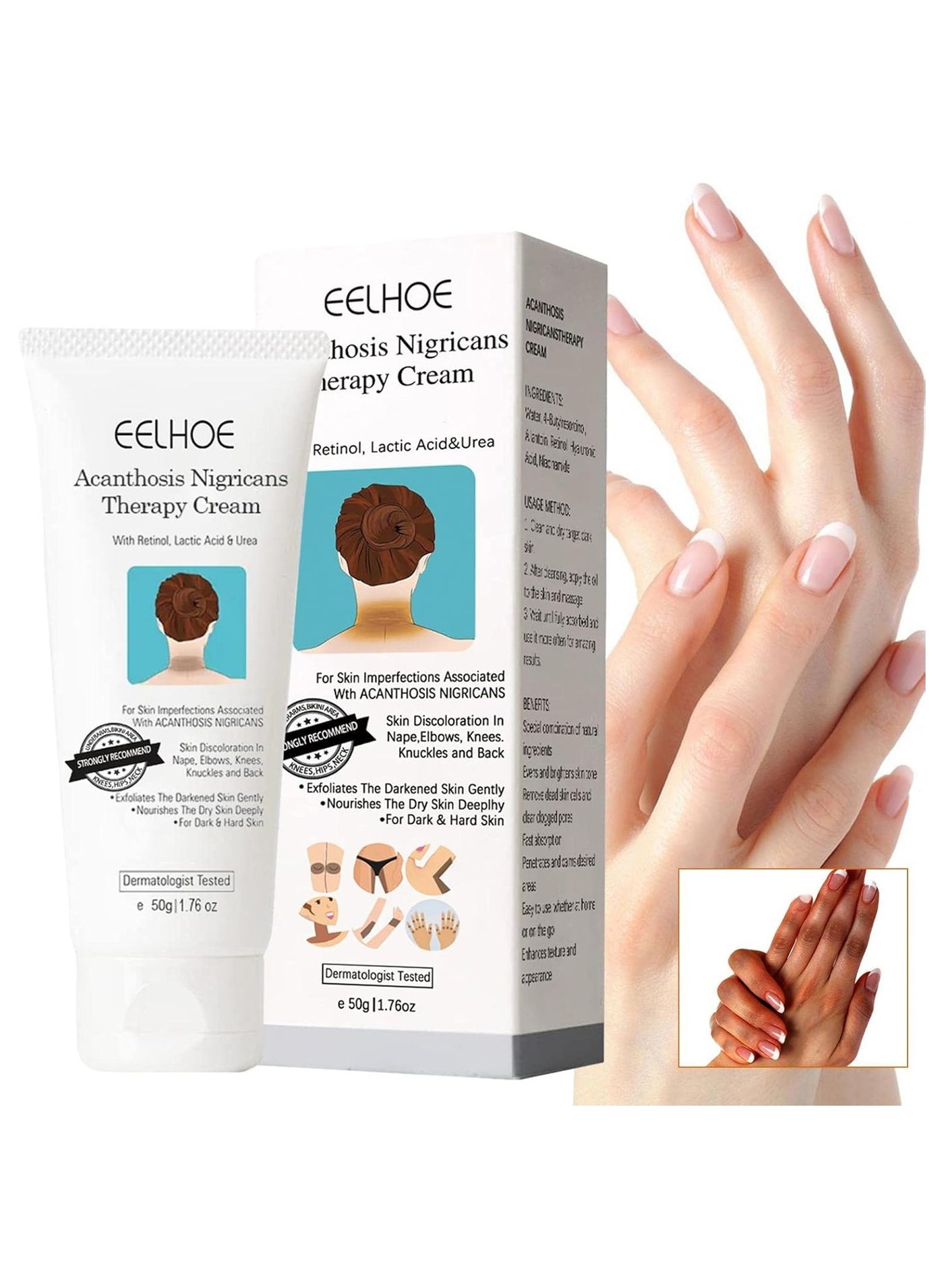 Acanthosis Nigricans Therapy Cream, Dark Spot Corrector Cream Retinol Cream, Nigrifix Cream with Lactic Acid, Removal of Hyperpigmentation for Dark Body Parts