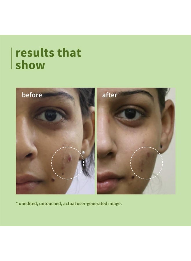 Green Tea Pore Cleansing Face Wash 150ml | Gel-Based, Anti-Pimple, Gentle Exfoliating Cleanser, 5.07 fl oz - image 3