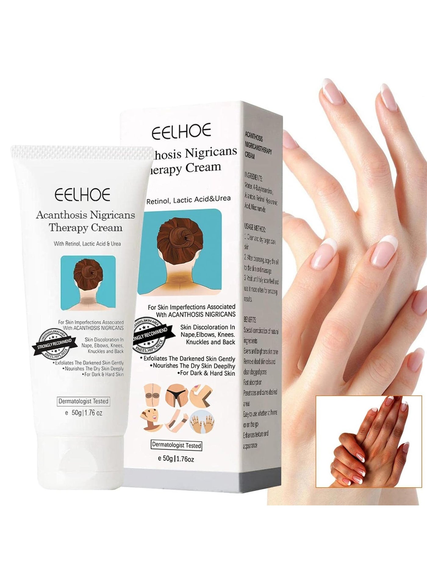Acanthosis Nigricans Therapy Cream, Dark Spot Corrector Cream Whitening Serum, Acanthosis Nigricans Treatment, Dark Spot Removal (1PCS)