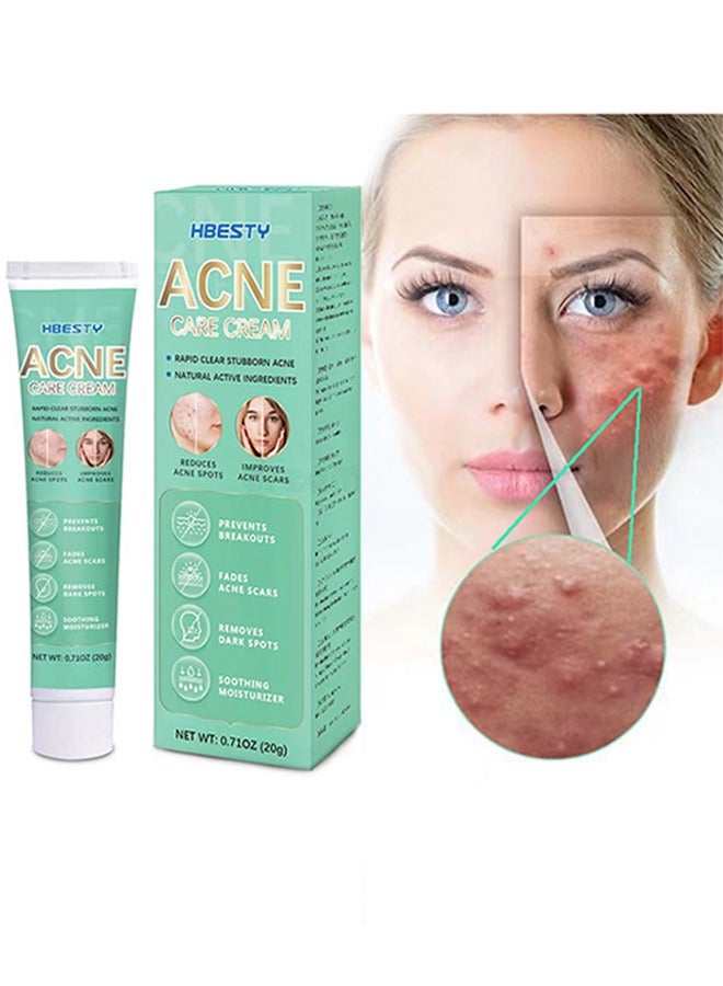 Acne Care Cream，Oil Control Anti Acne Facial Care ，Acne Spot ，Cystic Acne，Fungal Acne ，Face Acne Spot Treatment and Acne Scar Treatment Post Acne Marks Treatment，Pimple Remover， Acne Repair  20g