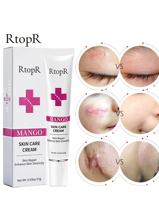 Mango Skin Care Cream，Scar Removal Anti Scar Skin Repair，Skin Repair Creams Treatment Stretch Marks Acne Surgical Care 15g