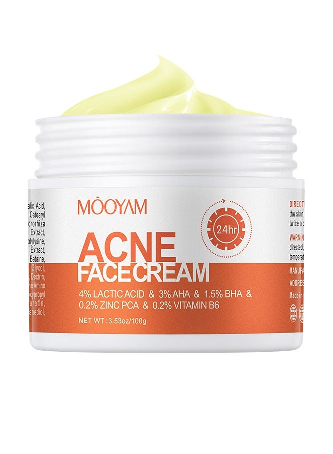 Acne Treatment for Face for Hormonal Cystic Stubborn Acne Cream for Sensitive Skin Teens Adults 100g