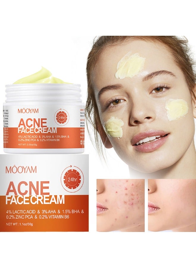 Acne Face Cream-4% Lacticacid & 3% AHS & 1.5% BHS  &0.2% Zinc Pca & 0.2% Vitamin B6, Lactic Acid Treatment Cream Acne AHA Face Cream Anti-Acne Moisturizer 30g