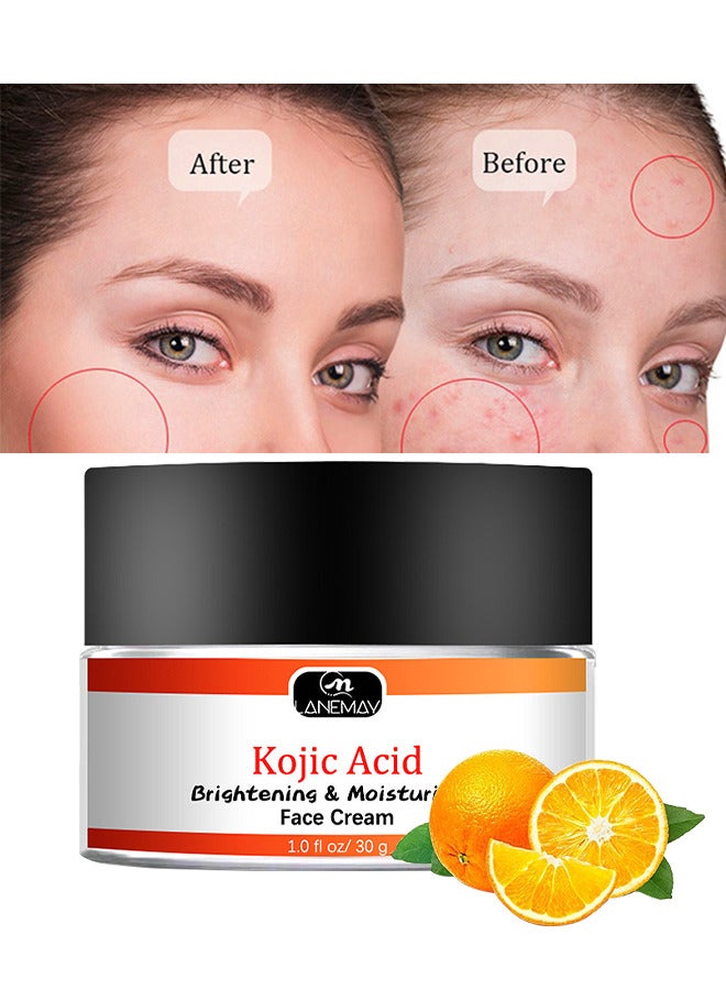 Kojic Acid Face Cream 30G, Moisturizing Brightening The Skin, Lightweight Non-Greasy Deep Penetration Anti-Aging，Spots Or Acne Scars In A Effective Way