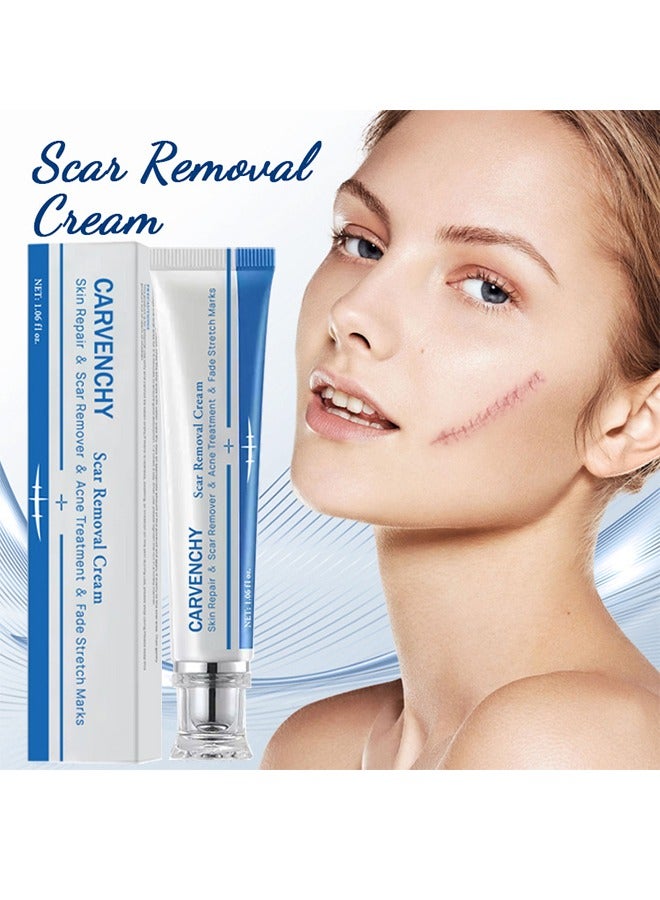 Scar Removal Cream - Acne Scar Cream Rapid Repair Scar Cream for Acne Surgery Injury Burns Advanced Gel Acne Scar Spot Treatment Suitable for All Skin Types 30g