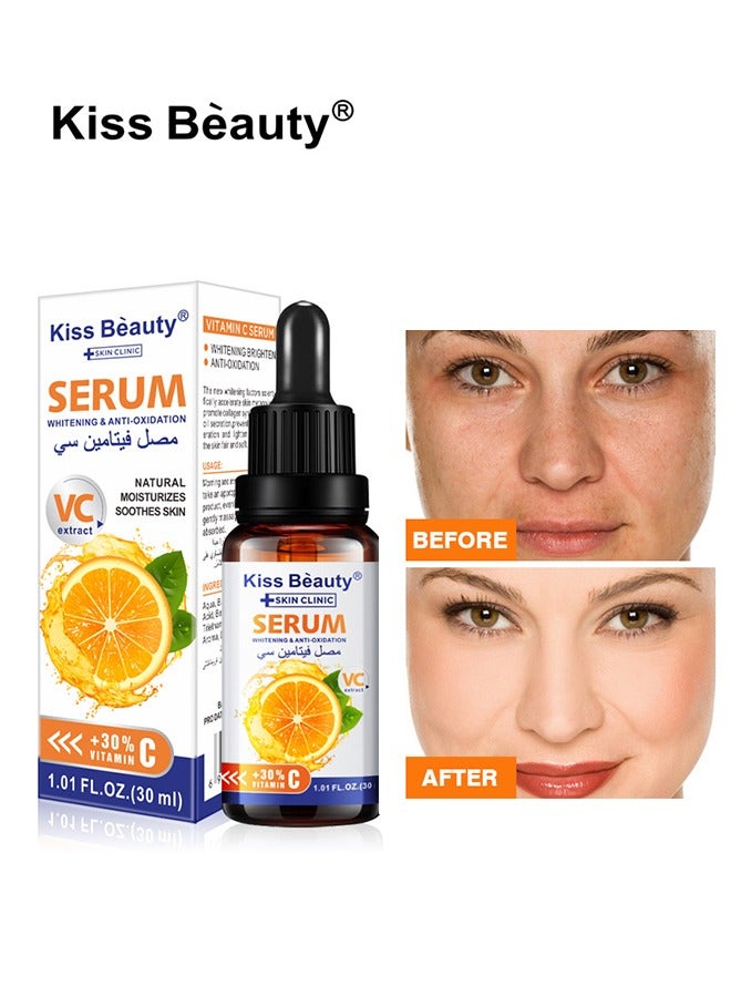 VC Whitening & Anti-oxidation Serum,Natural Moisturizes Soothes Skin,Vitamin C Face and Eye Care  Help Fade Sun Spots Organic Anti-Aging Serum (30ml)