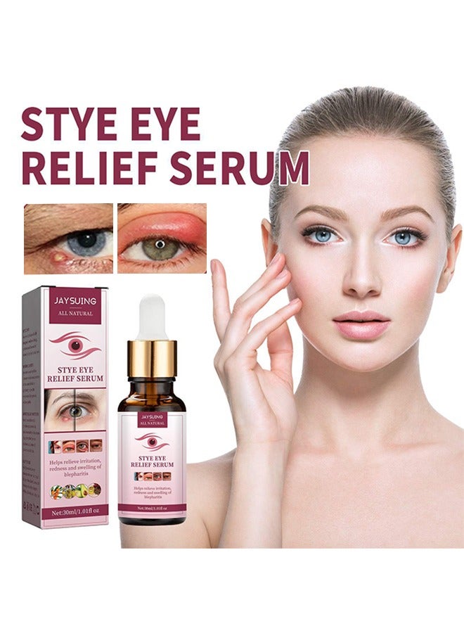 Stye Eye Relief Serum 30ml, Stye Eye Treatment, Eye Stye Remover, Chalazion Remover, Stye Eye Relief Serum for Styes Chalazion and Blepharitis Treatment, Eye Care, Mild Lash and Eye Cleanser