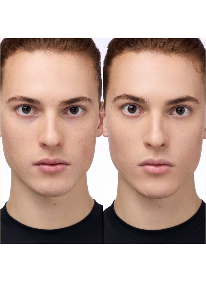 Instant Bright Serum Concealer 032N - image 5