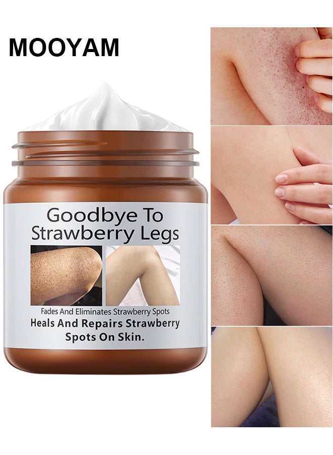 Strawberry Legs Treatment For Women Rough Bumpy Body Cream Lotion For Dry Skin Strawberry Skin Remover Keratosis Pilaris Treatment Moisturizing Cream Body Moisturizer For Spots Brightening Dry