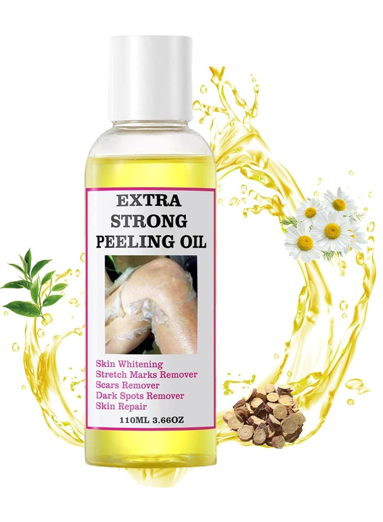 Extra Strength Yellow Peeling Oil, Exfoliating Oil for Dark Skin, Strong Exfoliating Oil Extra Strength, Exfoliating Peeling Solution, Body Scrub, Exfoliating Body, Yellow Shepherd Oil for Body All