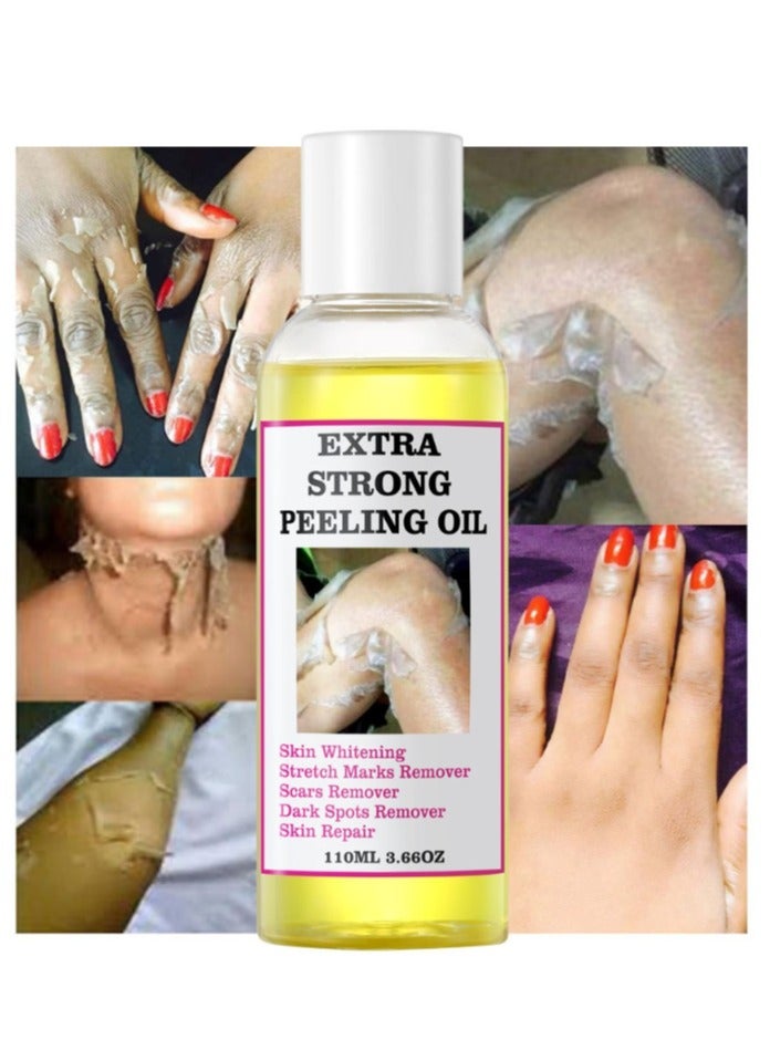 Yellow Peeling Oil 110ml Super Strength Dead Skin Remover Skin Moisturizing Hydrating Butter Peeling Remove Dead Skin and Calluses on Feet and Hand Dark Spot Peeling Oil