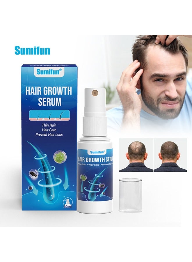 Hair Growth Serum -Scalp Care Hair Growth Spray-Ultra Hair Growth Formula Serum Spray, Grow Thicker Hair In 8 Weeks-30ML