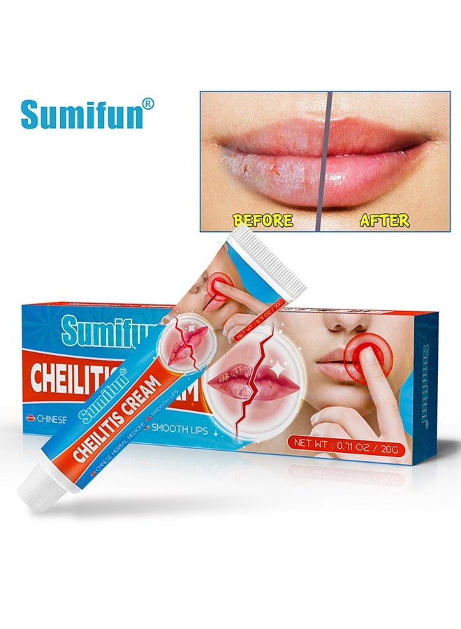 Cheilitis Cream-Chinese Herbal Medicine Smooth Lips,Repairing Chapped and Dry Lips | Natural Ingredients for Instant Cooling and Pain Relief | Dead Skin Removal/Fade Lip Lines/Improve Lip Color