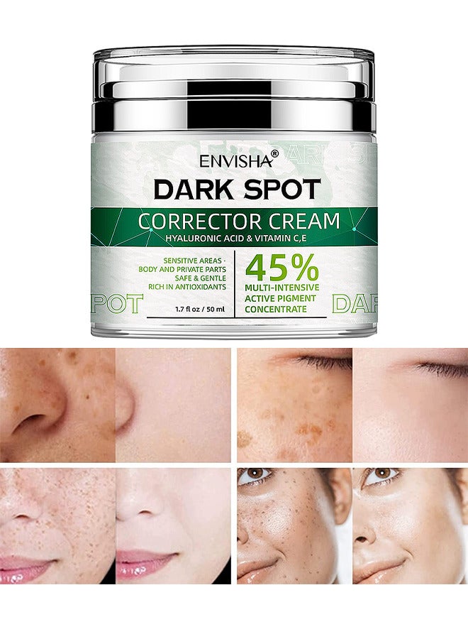 45% Dark Spot Corrector Cream, Dark Spot Remover For Face, Dark Spot Corrector Cream For Age Spot, Blemish Spot, Melasma, Freckle, Sun Spots Remover And Blemish Reducer For Women Or Men, 50ML