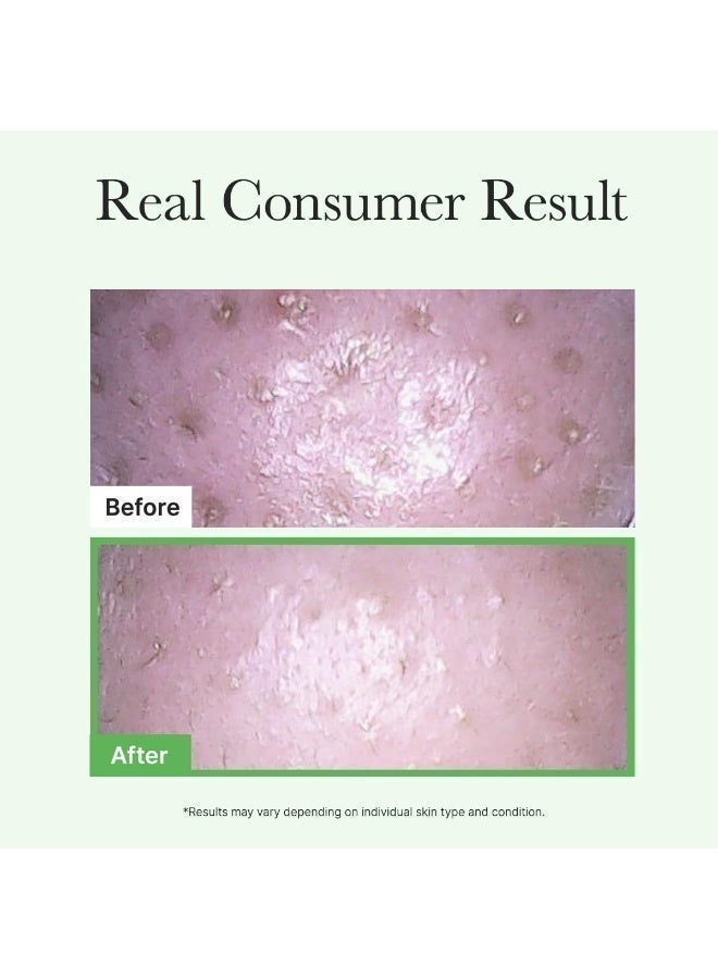 Pore Melt Mochi Makeup-Removing Cleansing Oil - image 7