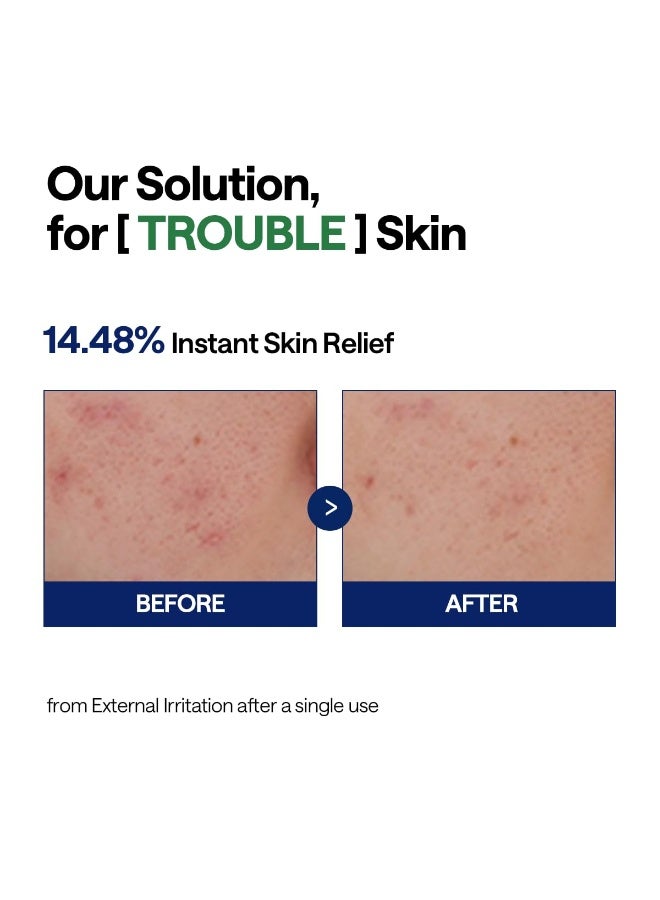 Tea Tree Calming Hydra Serum 40ml — Lightweight Hydrating Face Serum with Hyaluronic Acid, Tea Tree & Ceramide NP — For Sensitive, Oily & Dry Skin, 1.35 fl oz - image 5