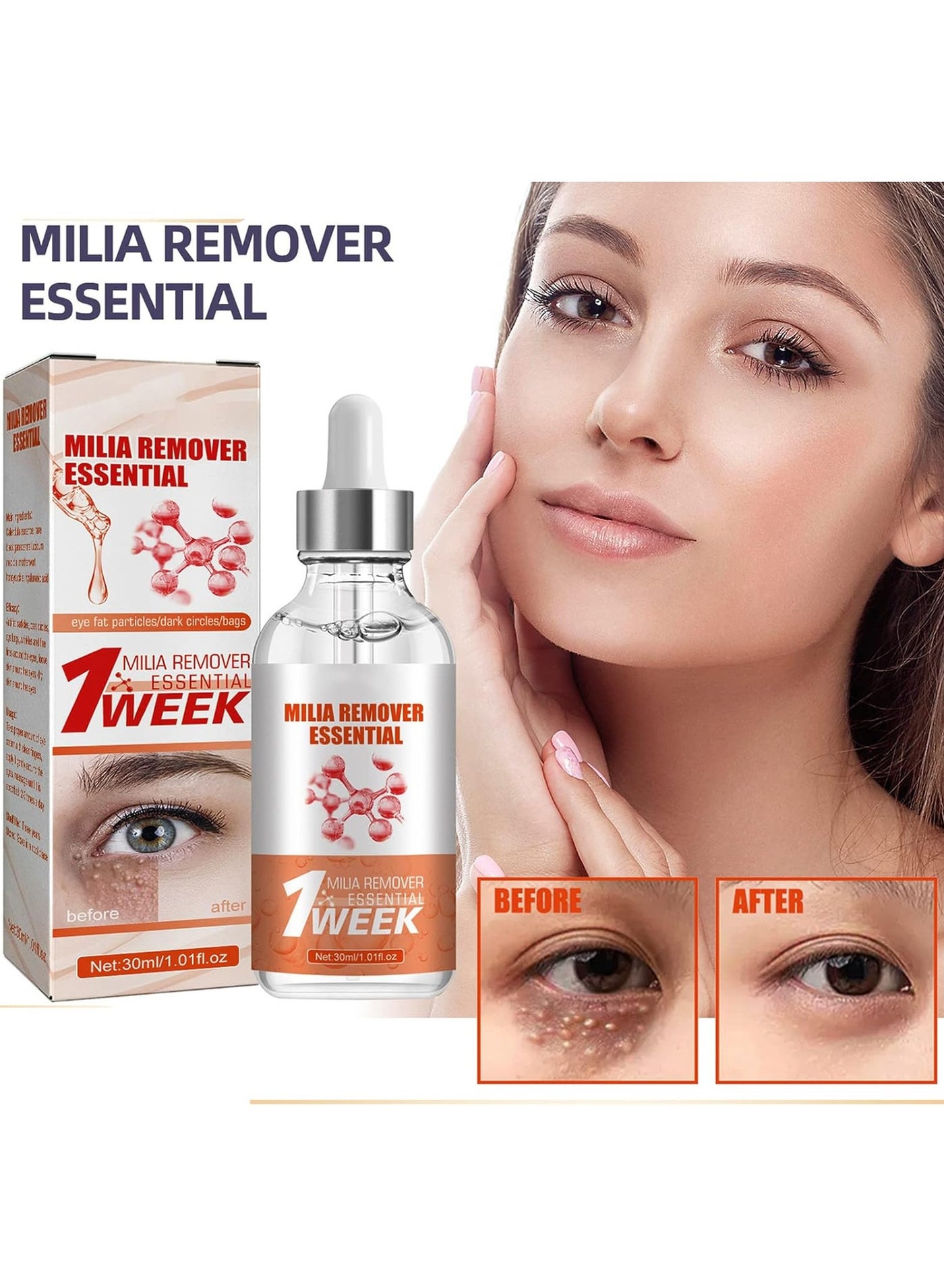Milia Remover Serum Anti Dark Circle Eye bags Fat Granules Deep Clean Liquid Anti-inflammatory Moisturizer Brighten Beauty Care
