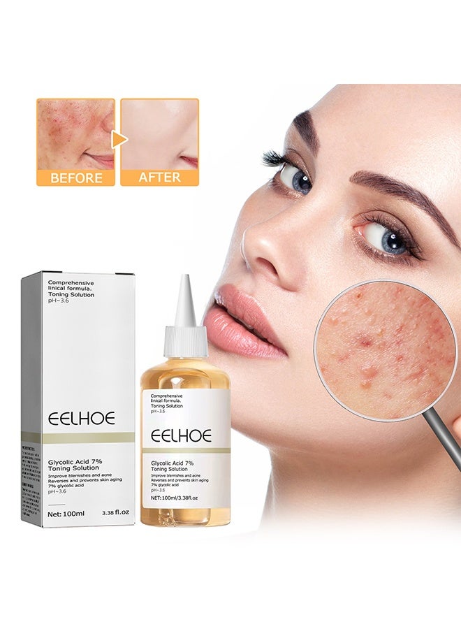 Glycolic acid 7% Toning Solution for Removing Acne, Reducing Acne Marks, Removing Closed Mouth Acne, And Repairing The Skin
