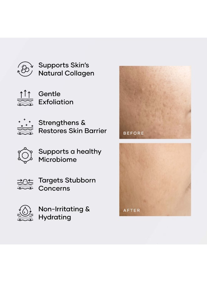 Cureskin Glyco Clear Cream | Repair Cream with Sustained Release | Glycolic Acid, Amino Acids and Prebiotics - image 3