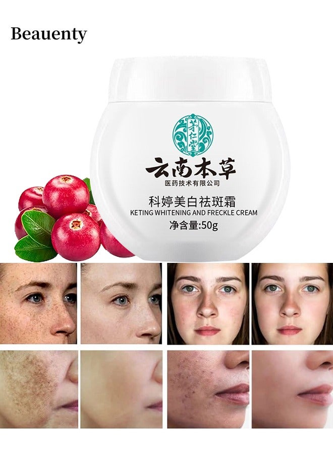 White Spot Cream, Whitening Freckle Cream Remove Melasma Cream, Dark Spot Remover For Face Hyperpigmentation Treatment, Dark Spot Corrector For Face, Smooth Skin Moisturizer Cream 50G