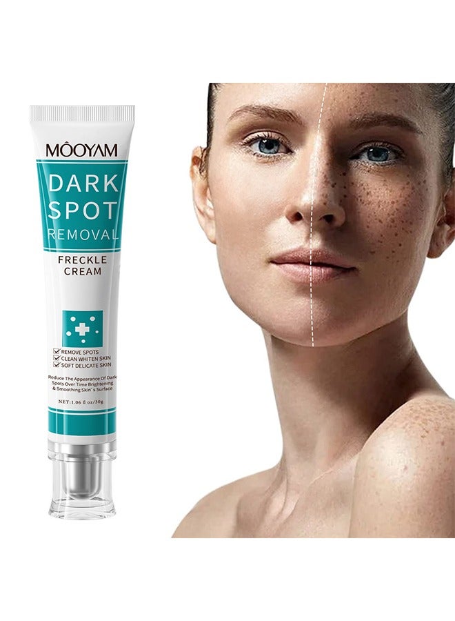 Dark Spot Removal Freckle Cream, Fast-Acting Dark Spot Corrector Remover For Face And Body Hyperpigmentation, Fades Melasma, Freckle, Sun Spots, Evens Skin Tone, Age Spot Remover