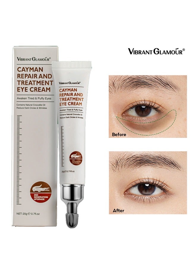 Cayman Repair and Treatment Eye Cream, Magic Eye Cream, Eye Cream to Remove Eye Bags, Wrinkles, Fine Lines, Dark Circles, Anti Aging Eye Cream, Lift Lighten Eye Cream, Eye Repair and Treatment  （20g）