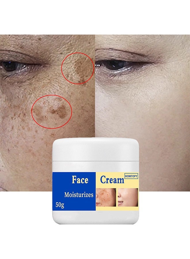 Face Cream，Dark Spot Remover for Face, Melasma Treatment, Hyperpigmentation Corrector, Spot Cream with Vitamin C and Glycerol, Fades Sun Spots and Freckles for Even Skin Tone 50g