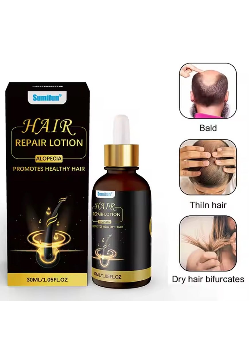 Hair Repair Lotion, Hair Oil, Hair Loss Treatment, Moisturizing Anti Loss Hair Growth Essence, Promote Healthy Hair, Strengthen Hair Growth 30ml