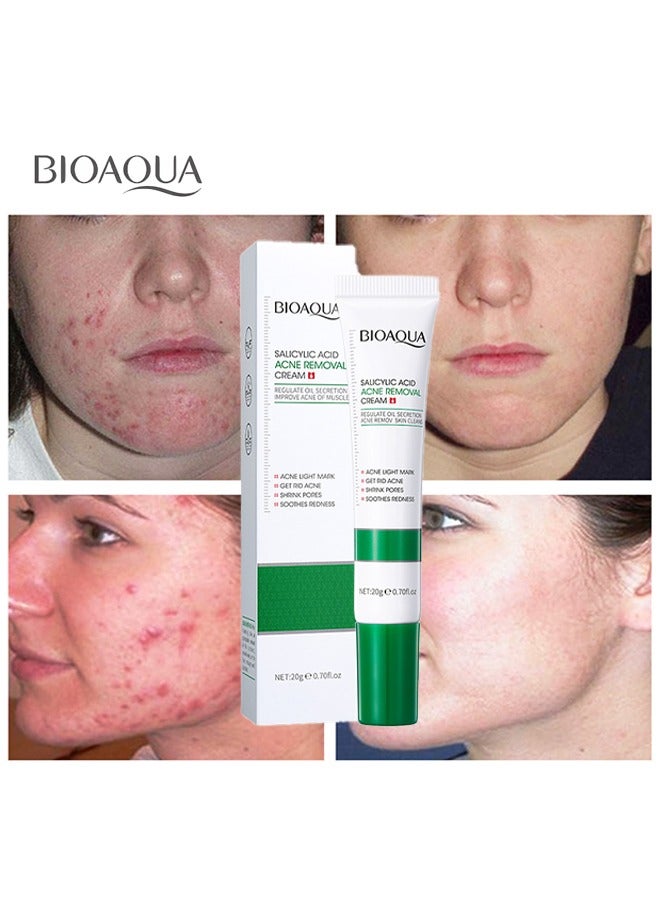 Salicylic Acid Acne Removal Cream , Acne Treatment Face Cream, Acne Spot Treatment for Face & Acne Dots, Natural Cystic Acne Treatment, For All Skin Types, Premium Acne Scar Cream & Pimple Remover20g