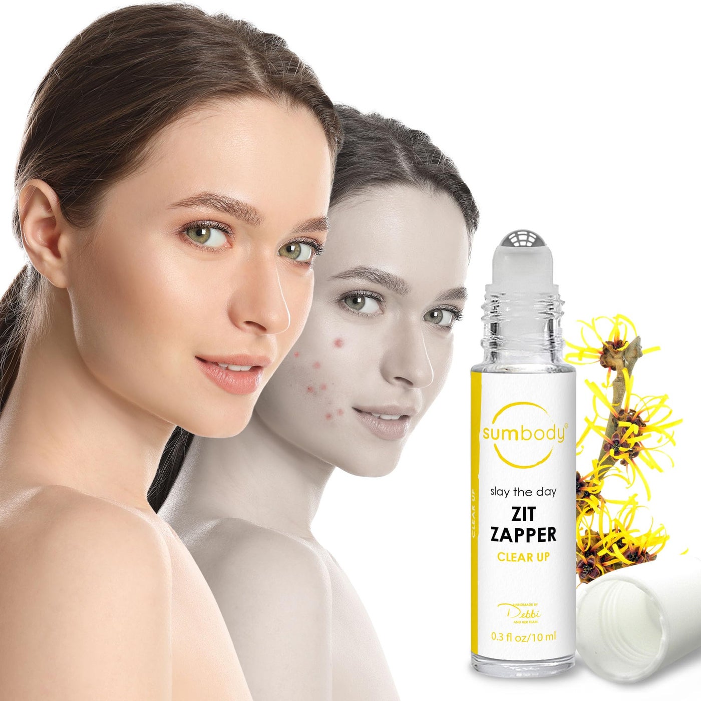 Sumbody Acne Serum for Face Zit Zapper - Blemish Pimple Reducer Women Men Teens, Facial Serum Acne Scars, Red Spot Remover & Pore Reducer Roll-On, Skin Care Formula Clear Skin, Made in USA