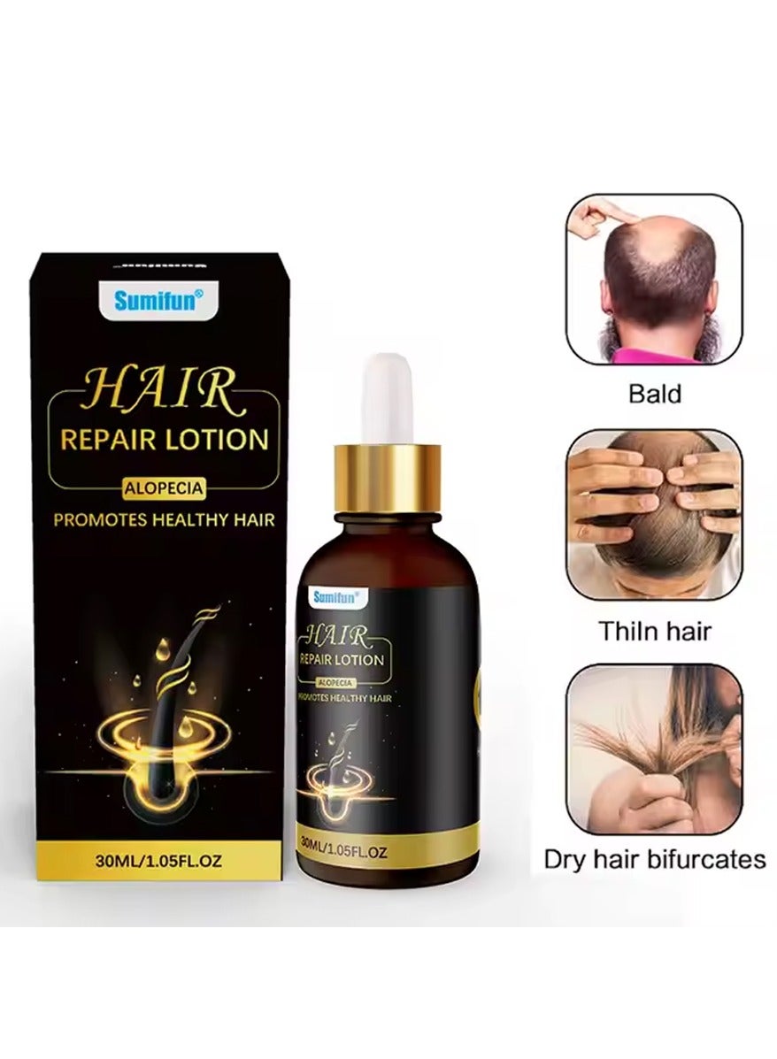 Hair Repair Lotion, Hair Oil, Hair Loss Treatment, Moisturizing Anti Loss Hair Growth Essence, Promote Healthy Hair, Strengthen Hair Growth 30ml
