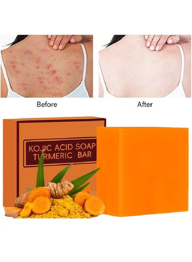 Kojic Acid Soap Turmeric Bar- Anti-acne Dark Spot Corrector Soap,Brightning Deep Cleansing Face and Body Turmeric Soap, Tretinoin Soap, Acne Facial Turmeric Kojic Acid Soap Bar